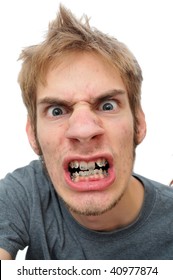 479 Ugly braces Images, Stock Photos & Vectors | Shutterstock