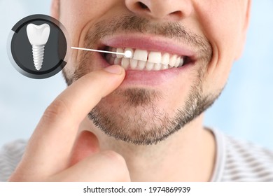 Man showing implanted teeth on light background, closeup - Shutterstock ID 1974869939
