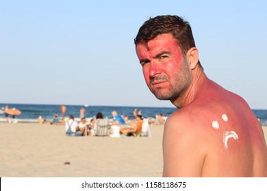 Man Suffering The Consequences Of Too Much Uv Light Exposure 