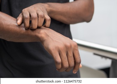 Man Suffering From Itching Skin; Sick African Man Scratching His Skin With Allergy, Rash, Ringworm, Tinea Problem; Health Care, Skin Care, Dermatology Concept; Adult African Man, Black Man Model
