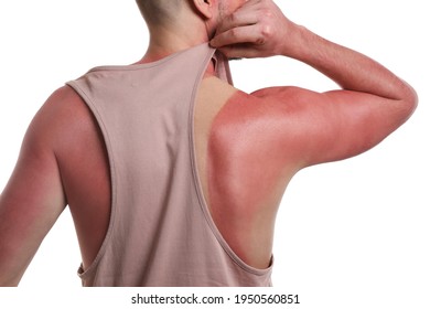 Man With Sunburned Skin On White Background, Closeup