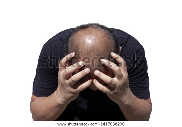 Man Thin Hair Men Have Hair Stock Photo Edit Now 1417038290
