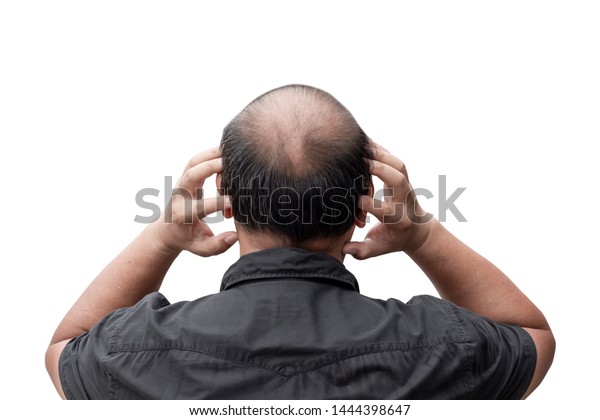 Man Thin Hair Men Have Hair Stock Photo Edit Now 1444398647