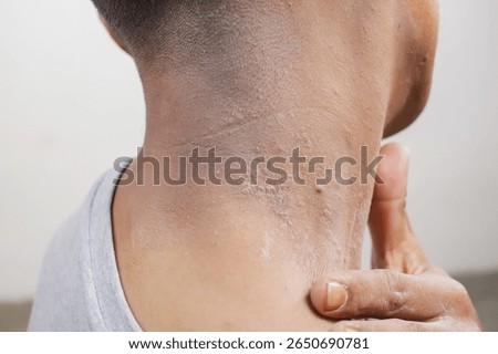 Man touches dry and rough patch on his neck skin.