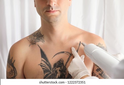 Man Undergoing Laser Tattoo Removal Procedure In Salon