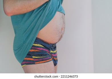 Man In Underwear With Fat Belly, Overweight Male Body Isolated On White Background. Lose Weight. Concept Of Surgery, Subcutaneous Fat Breakdown. Body Positive
