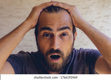 Man Using His Hand Slicking His Hair Back After Facing Hair Loss Problem By Taking Medicine Like Zinc And Biotin To Make His Hair Grow Faster And Thicker. Men Health And Medical Concept.