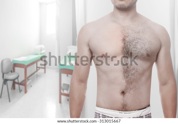 Man Waxing His Chest Depilate Hair Stock Photo Edit Now 313015667