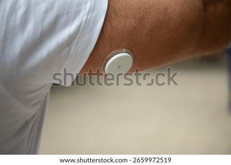 Man Wearing Freestyle Libre Sensor on Arm