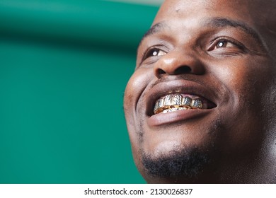 Man Wearing Gold Teeth Jewellery, Also Known As Teeth Grillsteeth Slugs, Photographed Against A Dark Green Background.