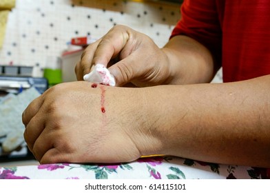 A Man Wiping Blood Cause By Home Injury