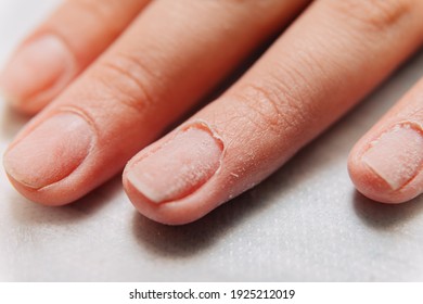 Manicure process. Cuticle on the fingernail.