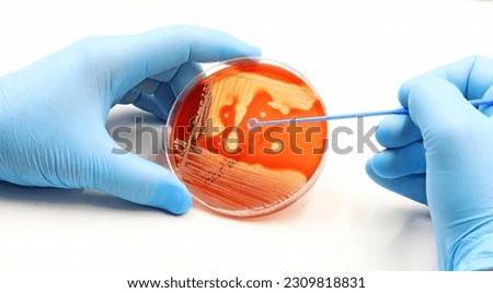 Manipulation of microorganisms in the Research laboratory. Methicillin-resistant Staphylococci MRSA