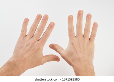 Man's Clean Hands Isolated On White Background With Copy Space. Clean Hands Save Lives Concept. Wash Your Hands, Prevent Infection From A Covid-19 