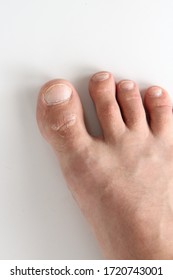 Mans Foot On A White Background. The Leg Of A White Man. Big Toe Closeup.