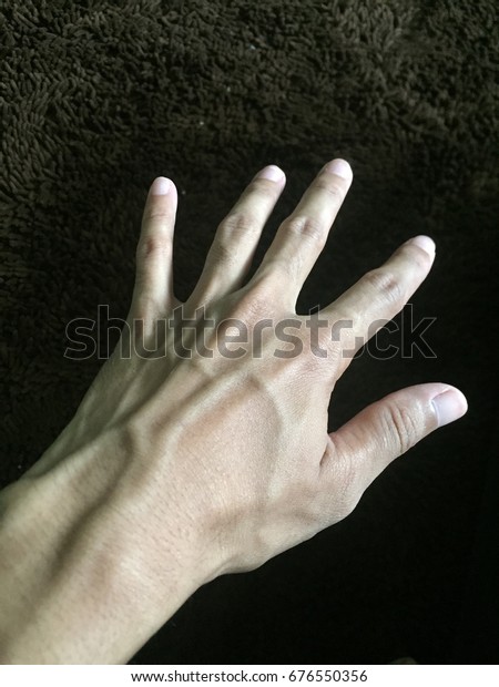 Mans Hand Blood Veins Stock Photo 676550356 | Shutterstock