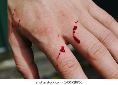 Blood Scratch Stock Photos Images Photography Shutterstock