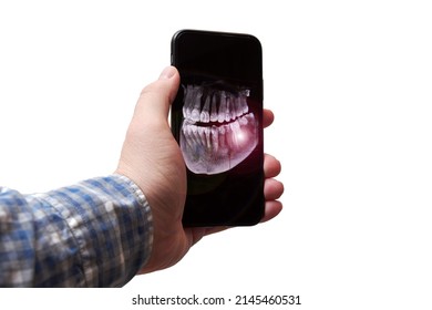 Man's Hand Holding A Mobile Phone With An X-ray Image Of His Jaw And Tooth. Pain Flare Highlight. Dentist And Medical Analysis