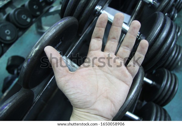 man\'s hand showing cracked skin because of the\
lifting exercise