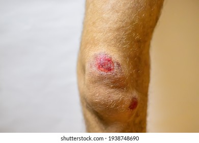 Mans Leg Injury Wound Blood Selective Stock Photo 1938748690 | Shutterstock