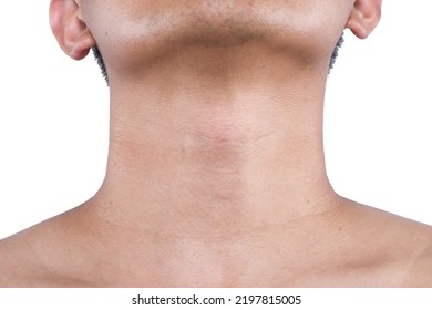 654 Adam S Apple Images Stock Photos Vectors Shutterstock 654 Adam S Apple Images Stock Photos Vectors Shutterstock