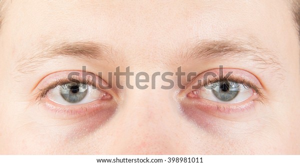 Man\'s tired gray eyes, clean\
skin