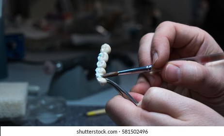 Manufacture Of Dental Crowns