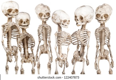 Many children's human medical skeleton over white