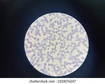 plasmodium falciparum under microscope