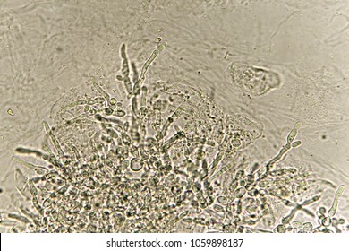 Many Pseudohyphae Budding Yeast Cells Patient Stock Photo Shutterstock
