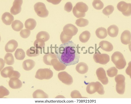 Marginal zone lymphocyte