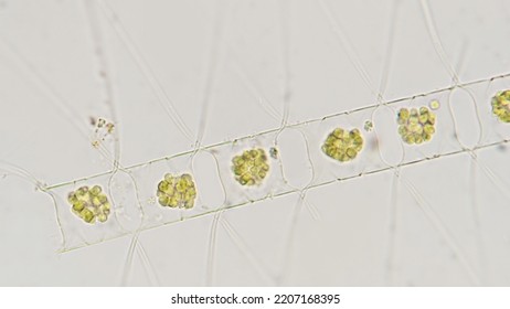 Marine Algae Called Chaetoceros. 400x Magnification With Selective Focus