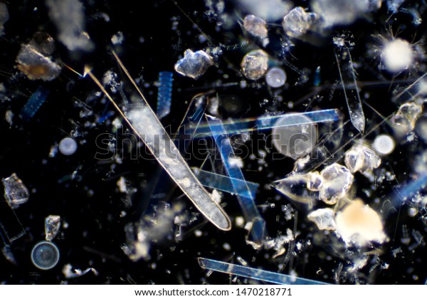 Marine aquatic plankton (Diatoms) under the\
microscope view.
