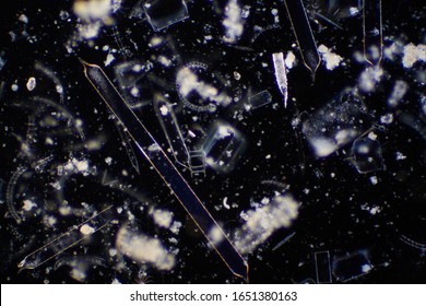 Marine aquatic plankton under the microscope view.