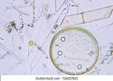 Marine aquatic plankton under the microscope view