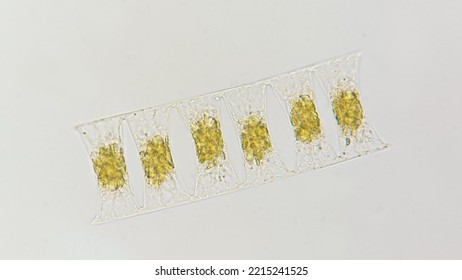 Marine Diatom Called Eucampia Sp. 400x Magnification With Selective Focus