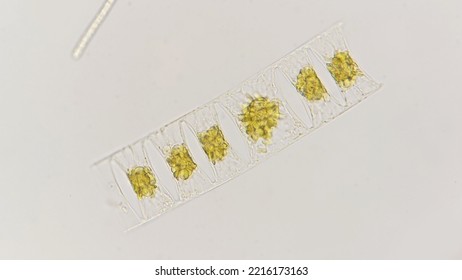 Marine Diatom Called Eucampia Sp. Lugol-fixed Sample. 400x Magnification