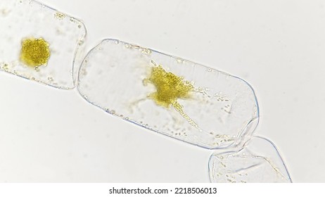 Marine Diatom, Marine Phytoplankton, Genus Chrysanthemodiscus. Lugol-preserved Sample. 400x Magnification