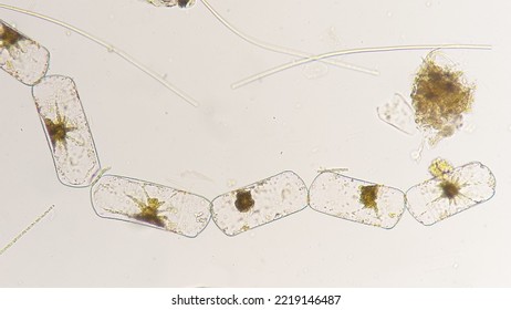 Marine Diatom, Marine Phytoplankton, Genus Chrysanthemodiscus. Lugol-preserved Sample. 400x Magnification