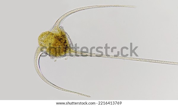 Marine\
dinoflagellate called Ceratium. Species: unknown. Lugol-preserved\
sample. 400x magnification with selective\
focus