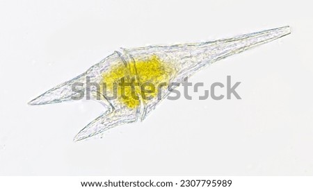 Marine dinoflagellate, Ceratium furca. Live cell. 400x magnification. Stacked photo