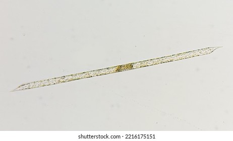 A Marine Golden Algae Genus Proboscia. Lugol-fixed Sample. 400x Magnification