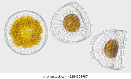 A marine phytoplankton, Campylodiscus sp. Marine diatom. Live cell. 40x objective lens. Selective focus