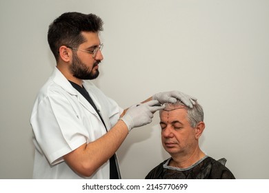 Marking hair line Point of receding hair line for hair transplant surgery.  - Shutterstock ID 2145770699