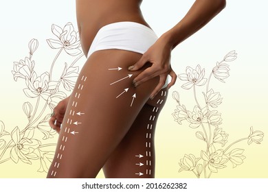 Marks or arrows on woman's buttocks and legs before plastic surgery. Lifting, beauty, bodycare, liposuction and healthy lifestyle concept. Female ass with lines. African young fit woman as model