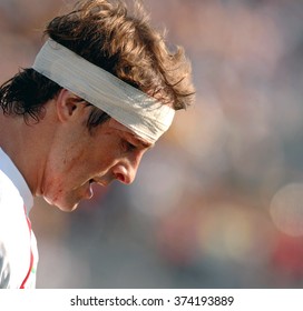 MARSEILLE, FRANCE-OCTOBER 06, 2007: England Rugby Player With Head Injury During The World Cup Match Australia Vs England, In Marseille.