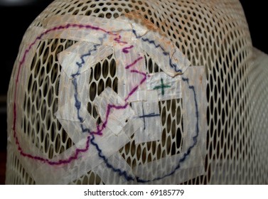 Mask Worn By A Brain Cancer Patient To Take Radiation Therapy.