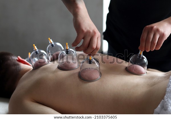 Massage vacuum cups. Close-up of man lying\
with banks on his back in spa salon. Vacuum jars in treatment and\
cosmetology. Vacuum therapy. Cup\
massage.