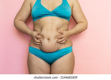 Massage Woman Sagging Belly With Hands Closeup, Folds On Stomach, Loose Skin And Cellulite. Naked Overweight Plus Size Girl On Pink Background In Blue Underwear. Concept Of Dieting And Body Control.