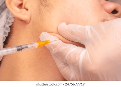 Masseter Jaw masseter botulinum toxin injection, also known as Jawtox procedure. - Powered by Shutterstock